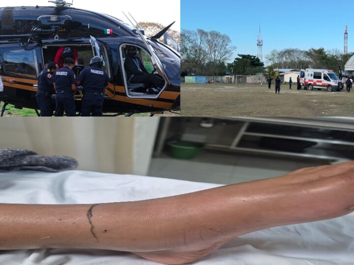 Una serpiente de cascabel muerde a una niña en una comisaría de Tizimín