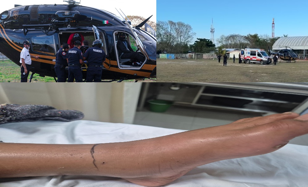 Una serpiente de cascabel muerde a una niña en una comisaría de Tizimín