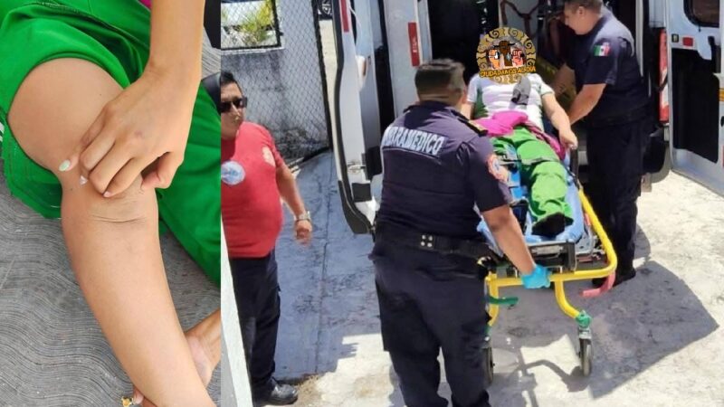 Alumna de una primaria de Izamal: Por falta de una ambulancia tardan horas para trasladarla una clínica  