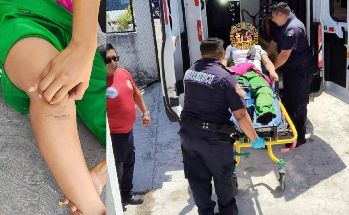 Alumna de una primaria de Izamal: Por falta de una ambulancia tardan horas para trasladarla una clínica  