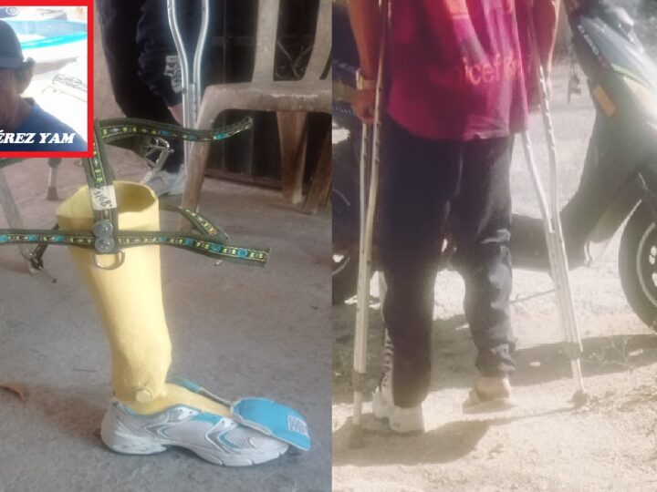 Pescador de Santa Clara diseña y elabora una prótesis de fibra de vidrio