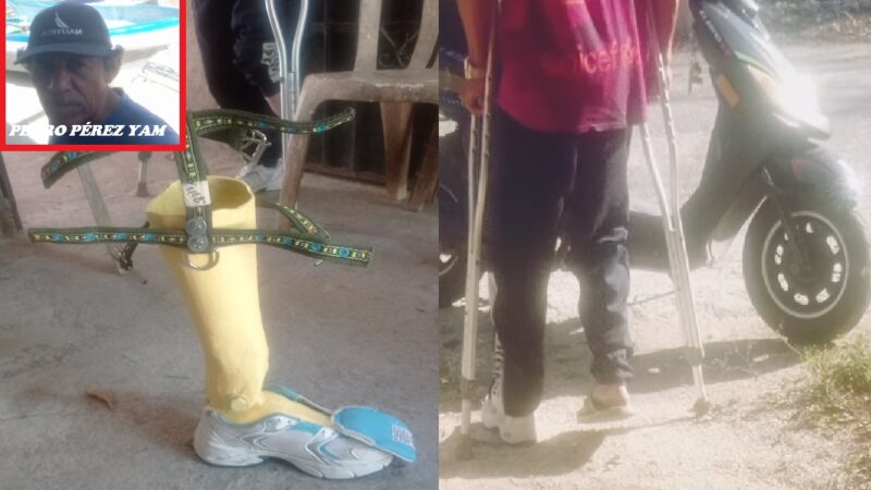 Pescador de Santa Clara diseña y elabora una prótesis de fibra de vidrio