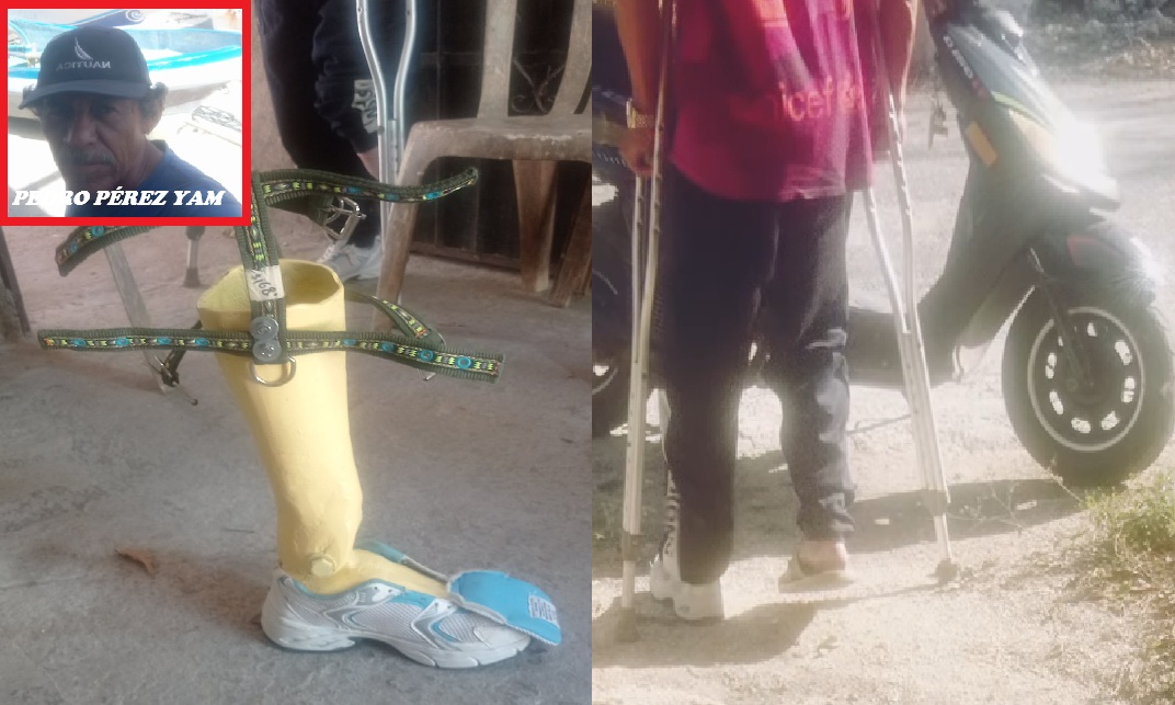 Pescador de Santa Clara diseña y elabora una prótesis de fibra de vidrio