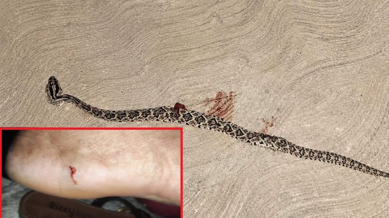 Una mujer la muerde una serpiente de cascabel en Oncán comisaria de Mérida