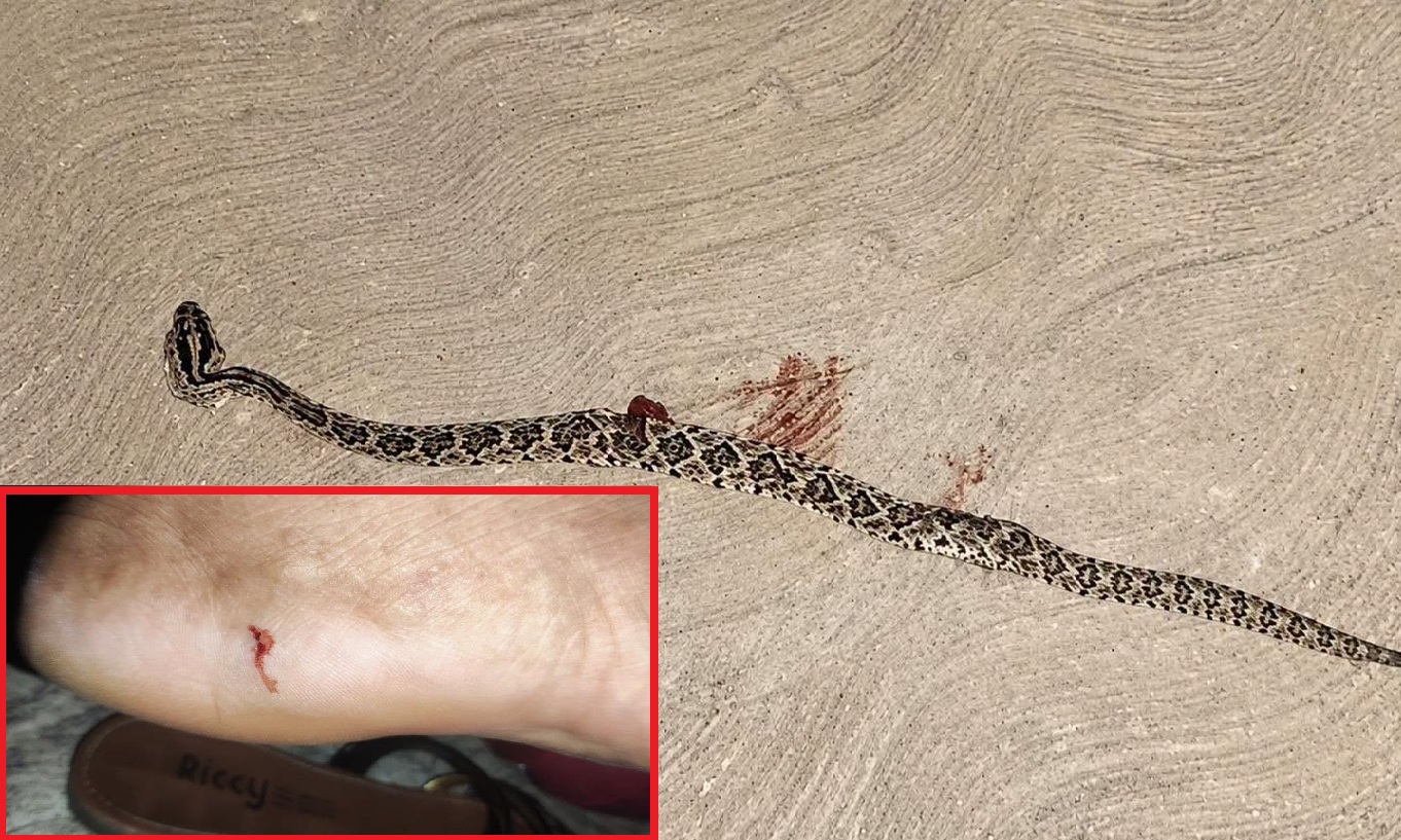Una mujer la muerde una serpiente de cascabel en Oncán comisaria de Mérida