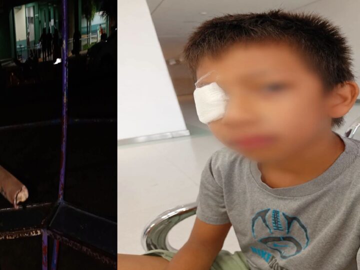 Negligencia de la comuna de Maxcanú: Un niño casi se saca un ojo en el parque infantil