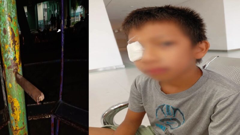 Negligencia de la comuna de Maxcanú: Un niño casi se saca un ojo en el parque infantil