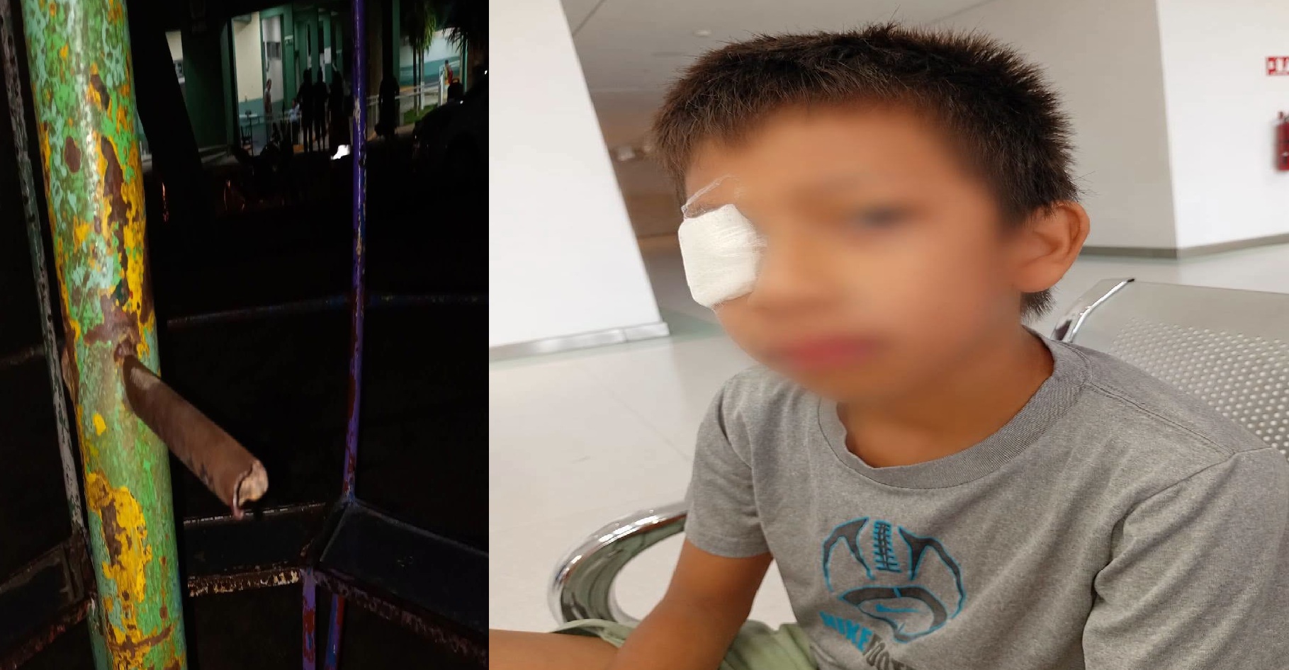 Negligencia de la comuna de Maxcanú: Un niño casi se saca un ojo en el parque infantil