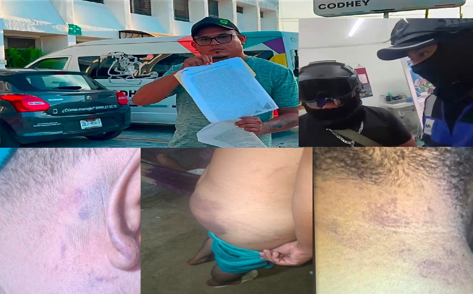 Al estilo “Sicarios” la policía de Motul es violenta y tortura dicen victimas